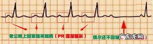 心电图详细图解 心电图怎么看图解