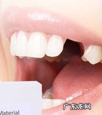 烤瓷牙一般能用多久 正常烤瓷牙能用多久