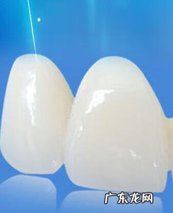 烤瓷牙一般能用多久 正常烤瓷牙能用多久