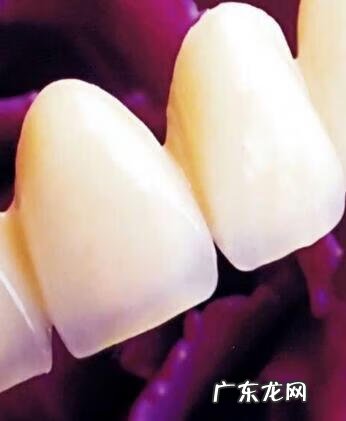 烤瓷牙一般能用多久 正常烤瓷牙能用多久