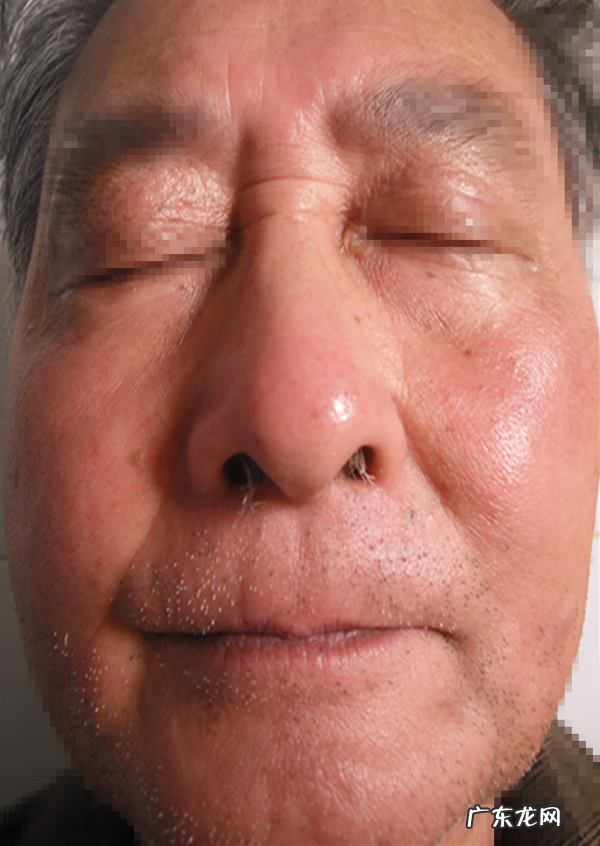 紫外线消毒灯的作用 紫外线消毒灯有用吗