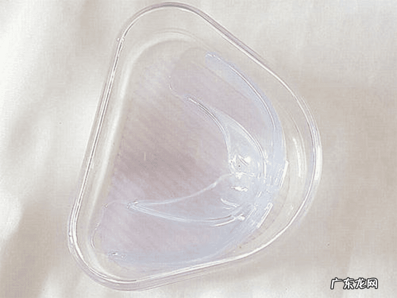 20岁地包天矫正多少钱 地包天矫正多少钱