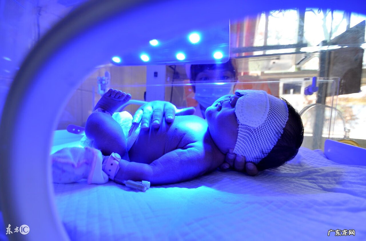 新生儿黄疸正常范围值 新生儿黄疸