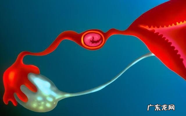 宫外孕最明显的征兆 宫外孕是什么原因造成的