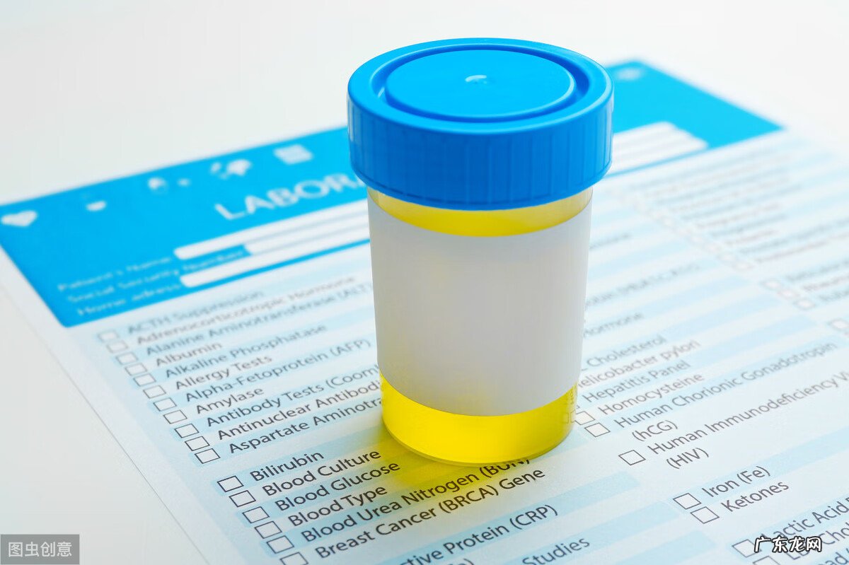 尿液分析包括哪些项目 尿液分析是检查什么