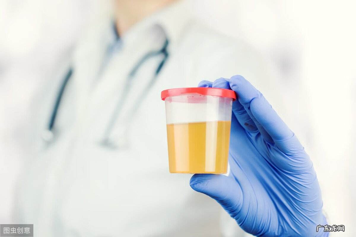 尿液分析包括哪些项目 尿液分析是检查什么