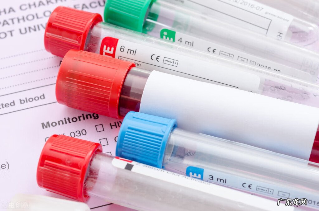 torch检查结果图 torch检查是什么