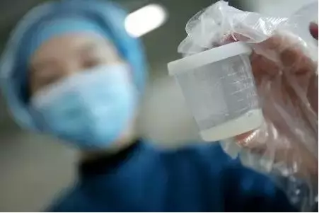 精子质量正常参考值 精液常规