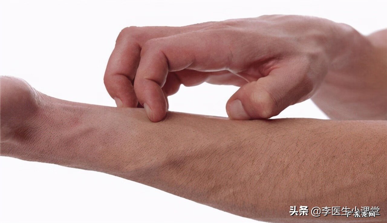 肛门奇痒无比,特别是夜里 女人肛门痒怎么办