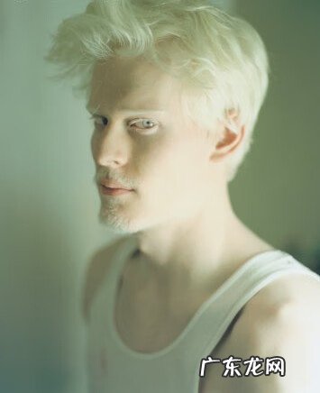 白化病前期有什么症状 轻度白化病症状