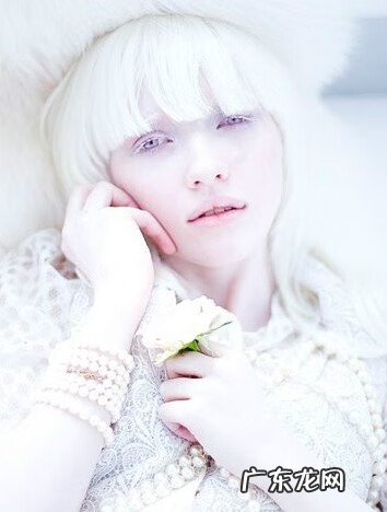 白化病前期有什么症状 轻度白化病症状