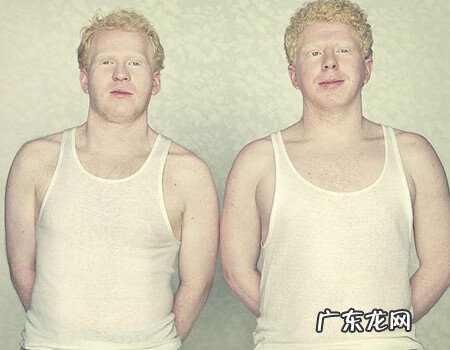 白化病前期有什么症状 轻度白化病症状