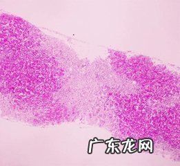 如何看尿常规化验单 尿常规化验单怎么看?