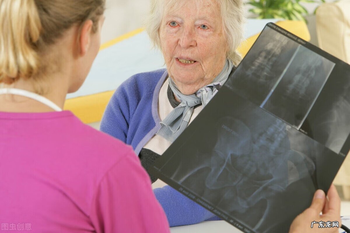 类风湿首选治疗方法 类风湿治疗哪家医院好