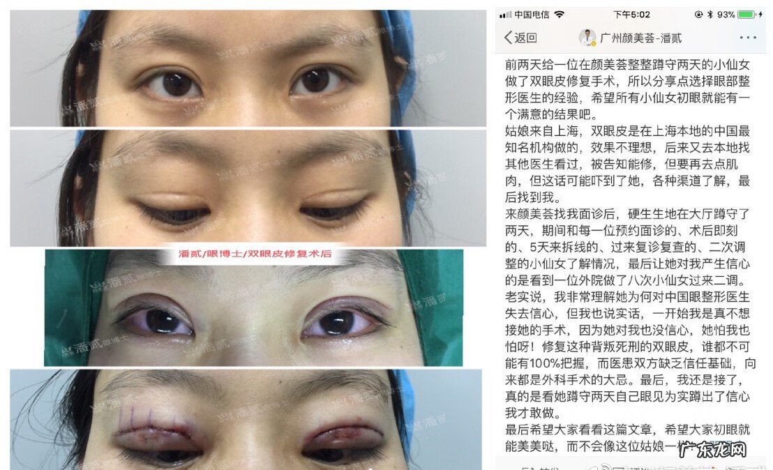 全脸整形需要多少钱 脸部整容费用