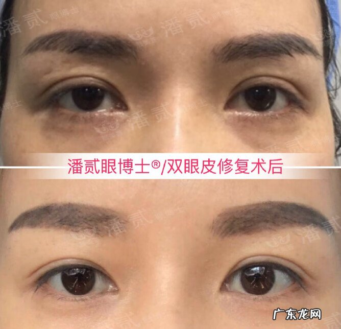 全脸整形需要多少钱 脸部整容费用