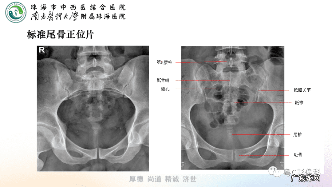 后侧体位展示 后侧位体视频