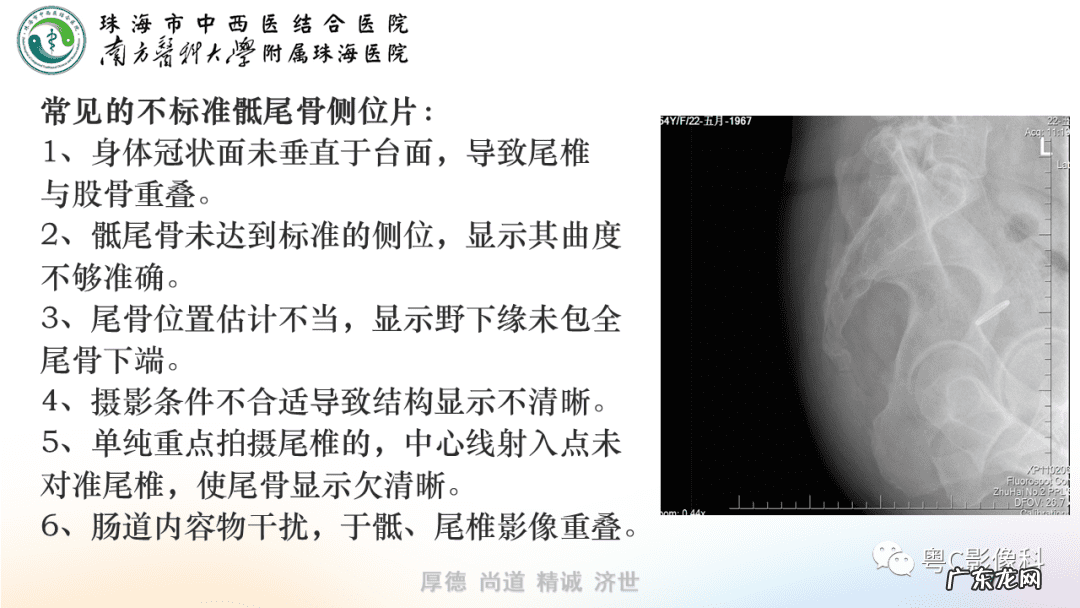 后侧体位展示 后侧位体视频