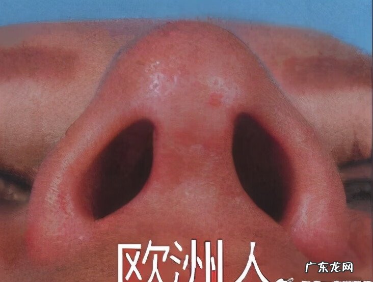 做什么动作可以让鼻子变小 鼻子大怎么变小