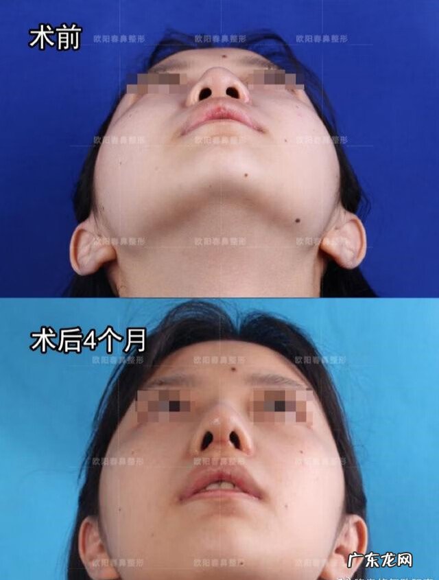 做什么动作可以让鼻子变小 鼻子大怎么变小