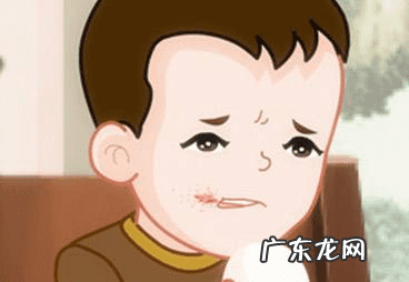 嘴角烂了是什么原因 两边嘴角烂了怎么办