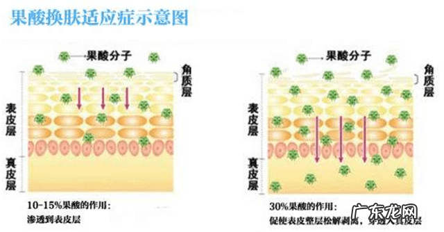 为什么果酸可以祛痘 果酸去痘痘