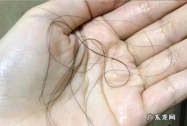 比较好的防脱发洗发水