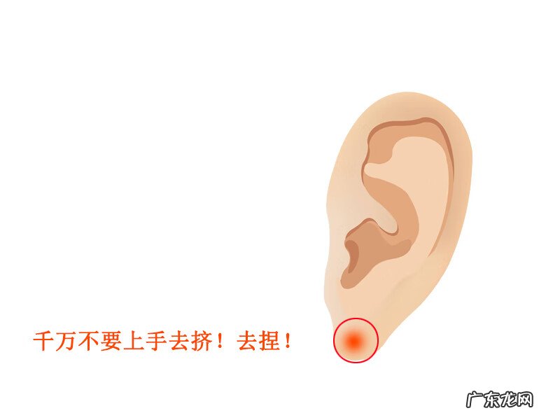 耳垂里面老是反复长硬疙瘩 耳垂里有硬疙瘩怎么办