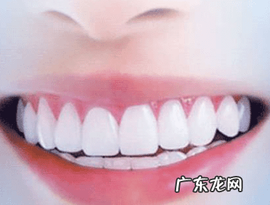 什么样的牙可以做烤瓷牙 烤瓷牙怎么做上去的