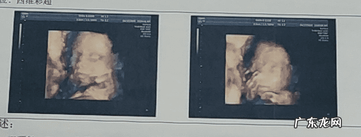 北京可以做四维彩超的医院 四维彩超医院哪好