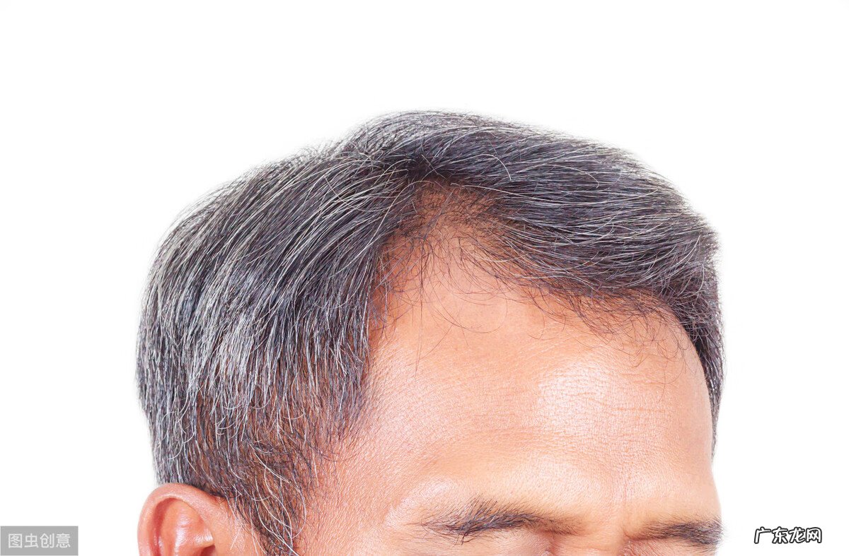 白发如何调理及治疗 白头发怎样治疗?