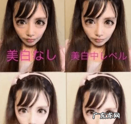 整容的脸能维持多少年 脸部整形一般多少钱