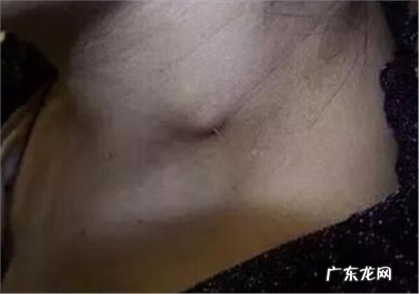 鱼刺卡住的感觉忽隐忽现 鱼刺卡住了怎么办?