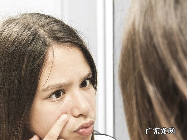 脸有痘痘怎么解决 脸上长痘痘怎么调理效果好