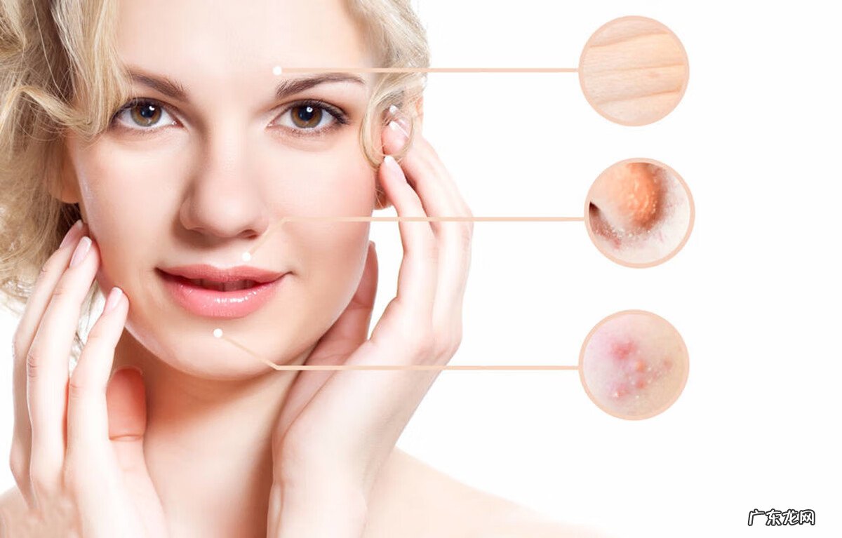 眉心反复长痘痘什么原因 男人眉心长痘痘是什么原因