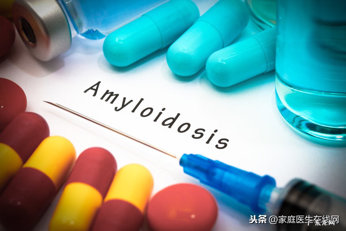 甲胎蛋白偏高原因 甲胎蛋白偏高说明什么问题