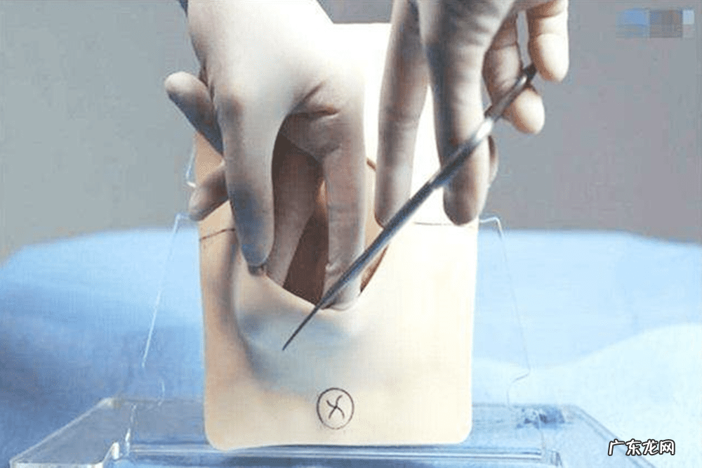 双顶径算男女的公式 胎儿双顶径是什么意思