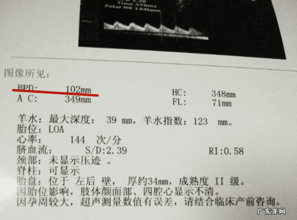 双顶径算男女的公式 胎儿双顶径是什么意思