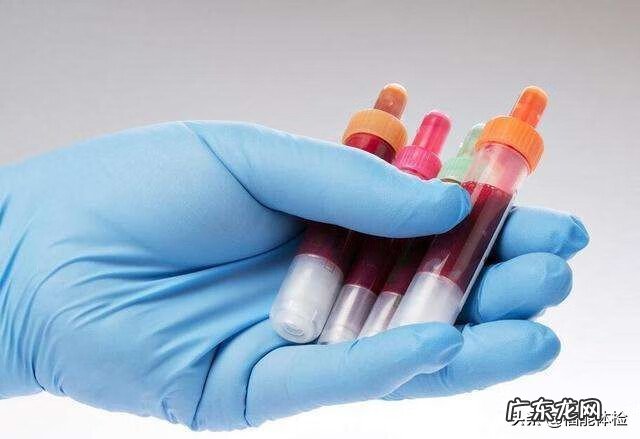 肝功能指标高 肝功能指标异常