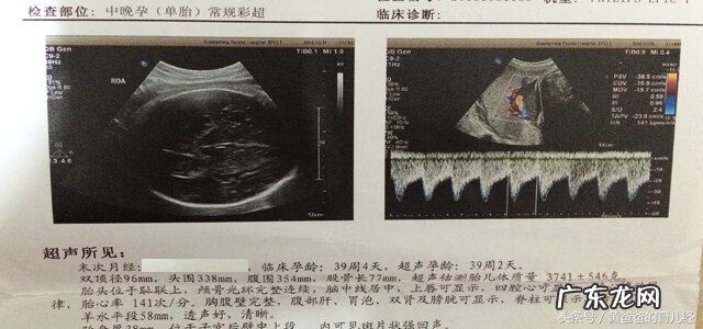 彩超怎么看胎儿性别 彩超看胎儿性别图解