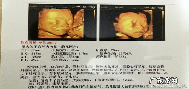 彩超怎么看胎儿性别 彩超看胎儿性别图解