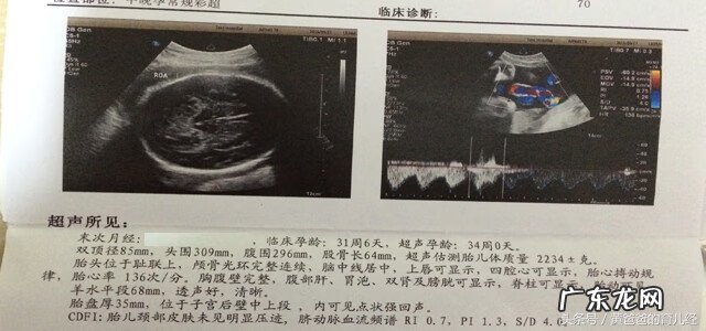 彩超怎么看胎儿性别 彩超看胎儿性别图解