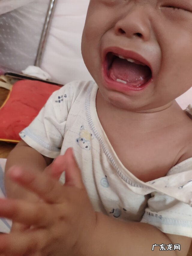 上嘴唇有白点颗粒状 嘴唇上有白点点是什么原因