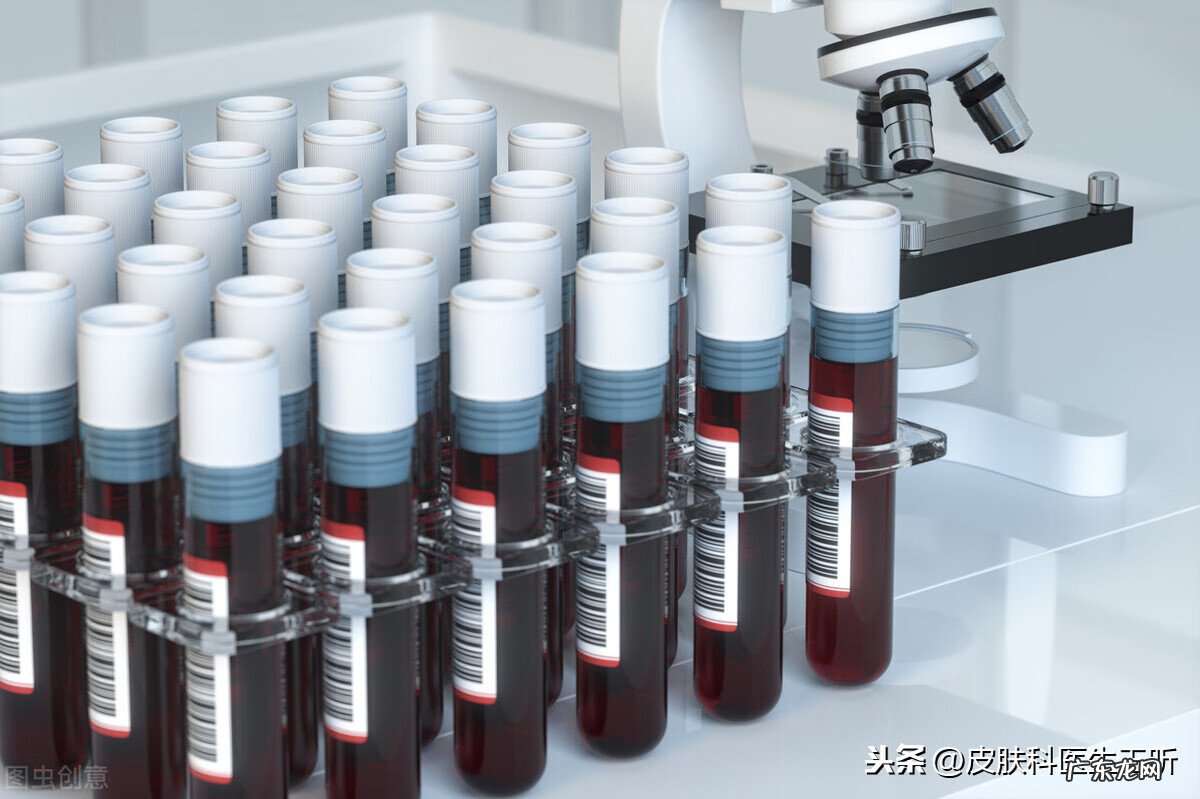 HPV检查怎么做 hpv检查是什么怎么做