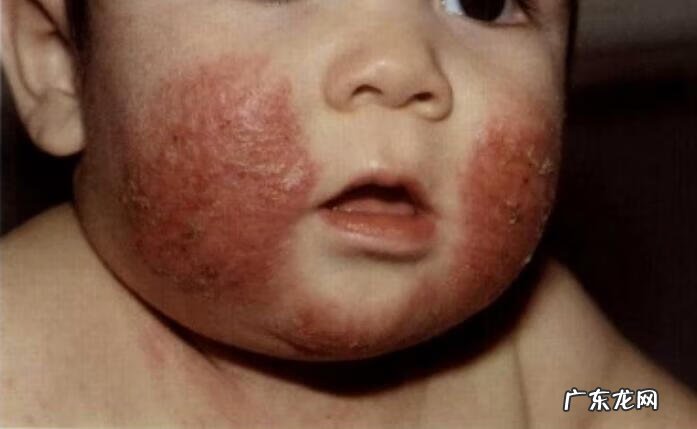 新生儿怎么护理照顾 新生婴儿怎样护理