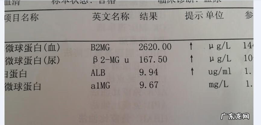 血常规检查结果主要看哪几项 血常规检查结果怎么看?