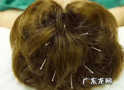 小脑萎缩严重吗 小脑萎缩是怎么引起的