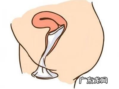 女性避孕套安全吗 女用避孕套