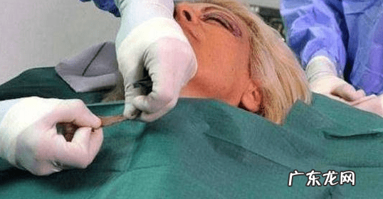 整容要多少钱一次 脸部整容需要多钱