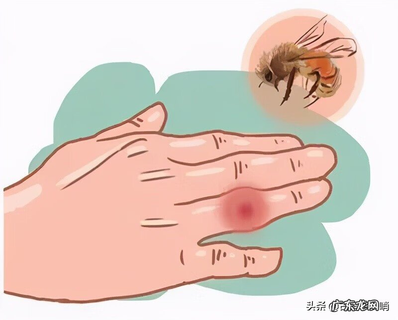 被蜜蜂蛰了怎么消肿止痒 被采蜜的蜜蜂蛰了怎么消肿